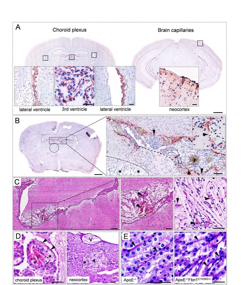 H4Fig. 6_Fibrillin-1 is expressed in the choroid plexus and capillaries of the neocortex, corresponding with the capillary basement membrane H4Fig. 6_Fibrillin-1 is expressed in the choroid plexus and capillaries of the neocortex, corresponding with the capillary basement membrane
