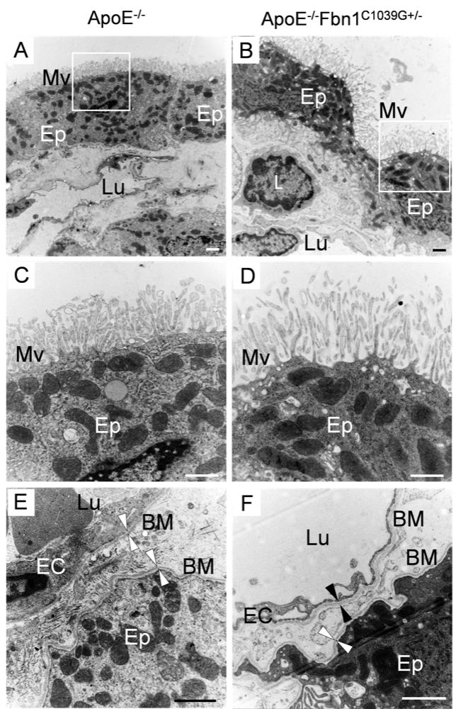 H4Fig. 7_Morphological changes in the choroid plexus of ApoEFbn1 mice on TEM H4Fig. 7_Morphological changes in the choroid plexus of ApoEFbn1 mice on TEM