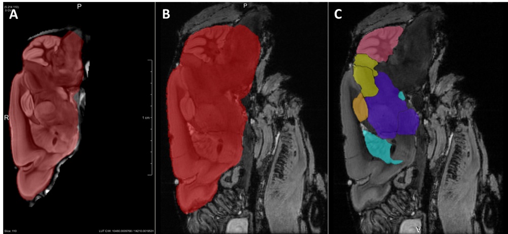 H5Fig 1_MRI-Neuropathology in mouse models for atherosclerosis H5Fig 1_MRI-Neuropathology in mouse models for atherosclerosis