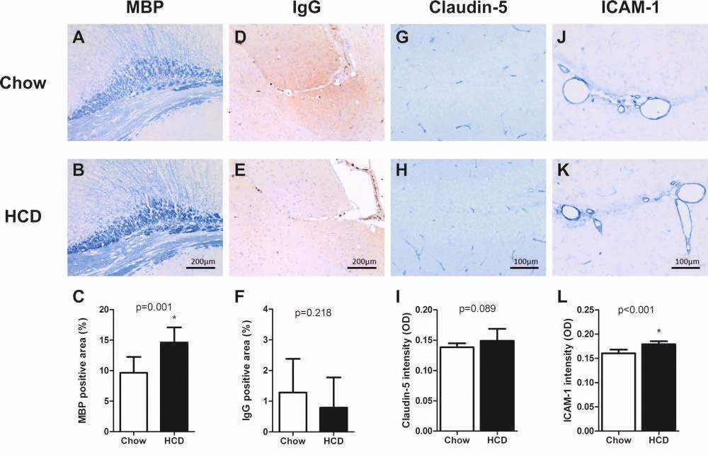 H5Fig 4_ApoE3LCETP H5Fig 4_ApoE3LCETP