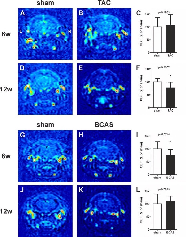 H6Fig 3_CBF H6Fig 3_CBF